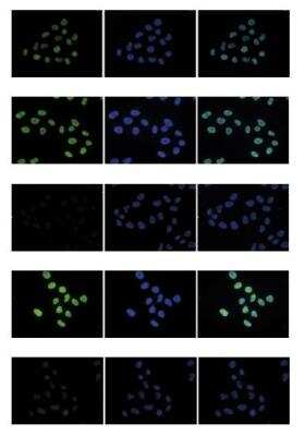 Immunocytochemistry/Immunofluorescence: Histone H4 [ac Lys5, ac Lys8, ac Lys12] Antibody [NBP2-59252] - HeLa cells were stained with Histone H4 [ac Lys5, ac Lys8, ac Lys12] Antibody and DAPI. Cells were fixed with 4% formaldehyde for 10' and blocked with PBS/TX-100 containing 5% normal goat serum and 1% BSA. (Top): cells were immunofluorescently labeled with the Histone H4 [ac Lys5, ac Lys8, ac Lys12] Antibody (left) diluted 1:500 in blocking solution followed by an anti-rabbit antibody conjugated to Alexa488. The middle panel shows staining of the nuclei with DAPI. A merge of the two stainings is shown on the right. Subsequent images show staining of the cells with the Histone H4 [ac Lys5, ac Lys8, ac Lys12] Antibody after incubation of the antibody with 10 ng/ul of the following blocking peptides: H4K5,8,12 unmodified, H4K5,8,12ac, H2A.ZK5,7,11ac and H4K5,8,12,16ac, respectively.